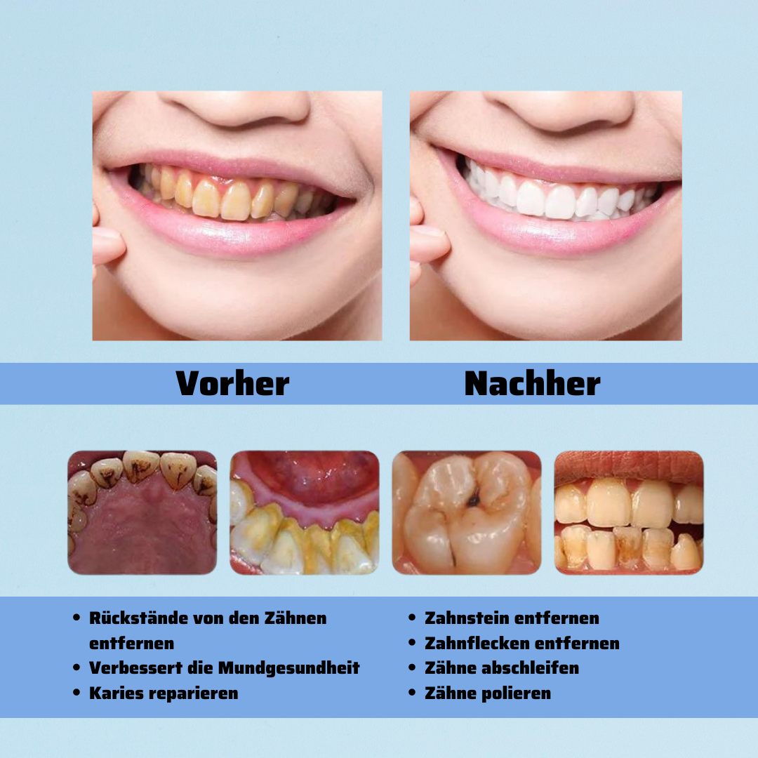 Zahnsteinentferner™ | Mit gesunden Zähnen ein Leben lang
