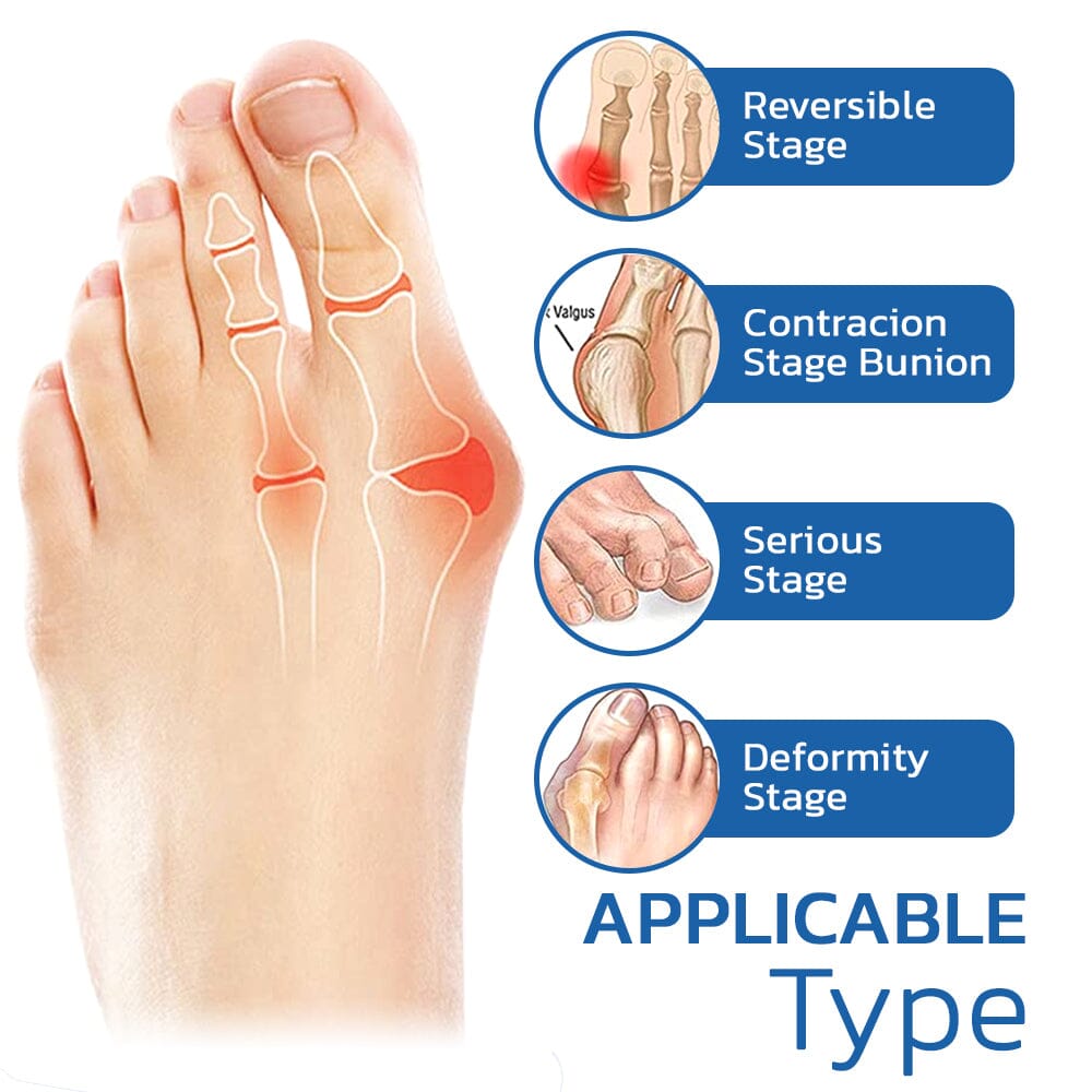 StepEase™ | Reduziert Fußschmerzen und fördert eine gute Körperhaltung - 1+1 GRATIS